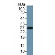 Serum Amyloid P Component (SAP) Antibody