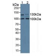 Collagen Type I Alpha 2 (COL1A2) Antibody