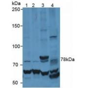 Matrix Metalloproteinase 9 (MMP9) Antibody