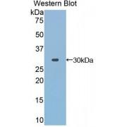 Toll Interacting Protein (TOLLIP) Antibody