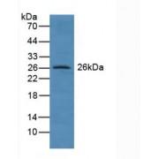 Glutathione S Transferase Alpha 4 (GSTa4) Antibody