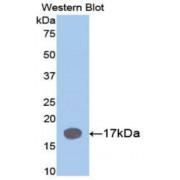 Interleukin 1 Receptor Antagonist (IL1RN) Antibody