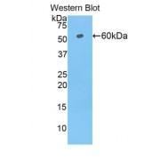 Telomeric Repeat-Binding Factor 1 (TERF1) Antibody