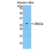A Disintegrin And Metalloprotease 9 (ADAM9) Antibody