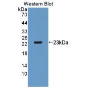 Metalloproteinase Inhibitor 2 (TIMP2) Antibody