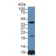 Metalloproteinase Inhibitor 3 (TIMP3) Antibody