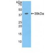 Colony Stimulating Factor 2 Receptor Beta (CSF2Rb) Antibody