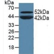 Peroxisome Proliferator Activated Receptor Alpha (PPARa) Antibody