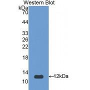 Serpin A12 (SERPINA12) Antibody