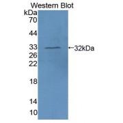 Absent In Melanoma 1 (AIM1) Antibody