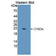 Interleukin 36 Alpha (IL36A) Antibody