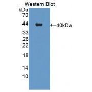 Cell Adhesion Molecule With Homology To L1CAM (CHL1) Antibody