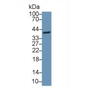 Coiled Coil Domain Containing Protein 3 (CCDC3) Antibody
