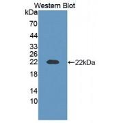 Contactin 2 (CNTN2) Antibody