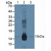 Damage Specific DNA Binding Protein 2 (DDB2) Antibody
