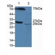 Serum Amyloid P Component (SAP) Antibody