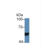 Hepatocyte Nuclear Factor 1 Beta (HNF1b) Antibody