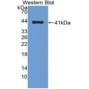 C-C Motif Chemokine Ligand 13 (CCL13) Antibody