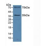 Sirtuin 2 (SIRT2) Antibody