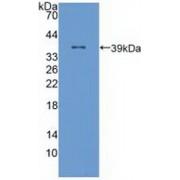 Polyunsaturated Fatty Acid Lipoxygenase ALOX12 (ALOX12) Antibody
