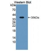 Latent Transforming Growth Factor Beta Binding Protein 2 (LTBP2) Antibody
