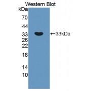 Amyloid Beta Precursor Protein Binding Protein A2 (APBA2) Antibody