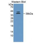 Cadherin EGF LAG Seven Pass G-Type Receptor 2 (CELSR2) Antibody