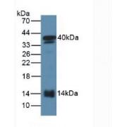 Serum Amyloid A2 (SAA2) Antibody