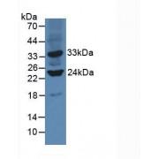 Sirtuin 3 (SIRT3) Antibody