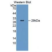 Phosphoprotein Associated With Glycosphingolipid Microdomains 1 (PAG1) Antibody