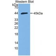 Hemicentin 1 (HMCN1) Antibody