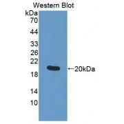 Matrix Metalloproteinase 9 (MMP9) Antibody