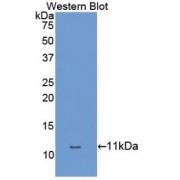 Dopamine Transporter / DAT (SLC6A3) Antibody