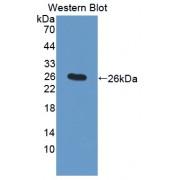 Amyloid Beta Precursor Protein Binding Protein 2 (APPBP2) Antibody