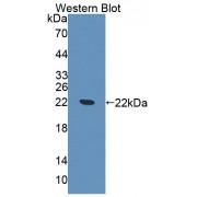 ATP Binding Cassette Transporter E1 (ABCE1) Antibody