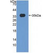Matrix Remodelling Associated Protein 5 (MXRA5) Antibody