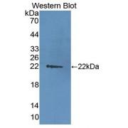 Damage Specific DNA Binding Protein 2 (DDB2) Antibody