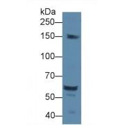 Docking Protein 1 (DOK1) Antibody