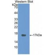 Calcitonin (CALCA) Antibody