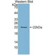 Metalloproteinase Inhibitor 1 (TIMP1) Antibody