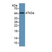 Plasminogen Activator Inhibitor 1 (SERPINE1) Antibody