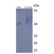 Human Calcitonin (CALCA) Peptide (OVA)