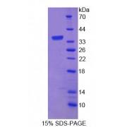 Rat Amyloid Beta Precursor Protein Binding Protein B3 (APBB3) Protein