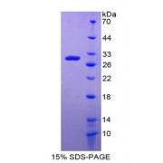 Human Damage Specific DNA Binding Protein 2 (DDB2) Protein