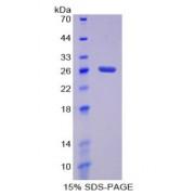 Mouse Damage Specific DNA Binding Protein 2 (DDB2) Protein
