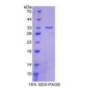 Mouse Breast Cancer Susceptibility Protein 1 (BRCA1) Protein