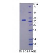 Mouse Nitric Oxide Synthase 1 Adaptor Protein (NOS1AP) Protein