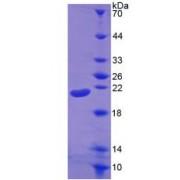Human Interleukin 1 Beta (IL1b) Protein