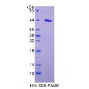 Mouse Serum Amyloid A2 (SAA2) Protein