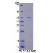 Mouse Amyloid Beta Precursor Protein Binding Protein A3 (APBA3) Protein
